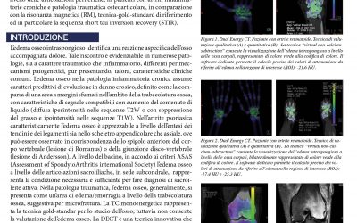 Studio dell’edema osseo mediante l’utilizzo della DECT nella patologia muscoloscheletrica infiammatoria e traumatica