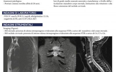 Caso clinico: Interessamento sternale e cervicale in artrite psoriasica